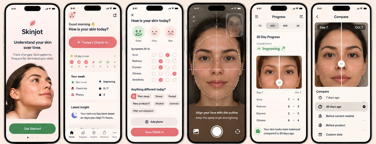 Skinjot ekranları: karşılama, ana ekran, günlük kayıt, yüz hizalamalı fotoğraf, ilerleme ve önce/sonra karşılaştırma